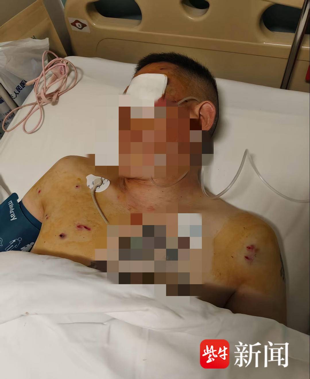 排球
_紫牛头条|男子取款170万在银行门口遭抢劫致重伤排球
,当事人认为银行保安未帮忙应担责