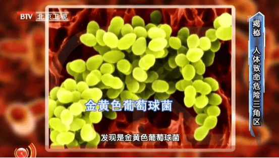 皇冠信用网申请_尽快扔掉！“甲醛超标”冲上热搜皇冠信用网申请，很多深圳人爱囤家里，比你想象得脏多了！网友炸锅